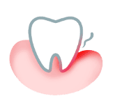 Ząb z czerwoną plamką