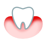 Ząb z czerwonym dziąsłem