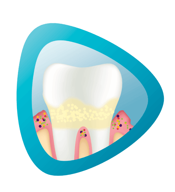 Obraz zęba na niebieskim i różowym tle