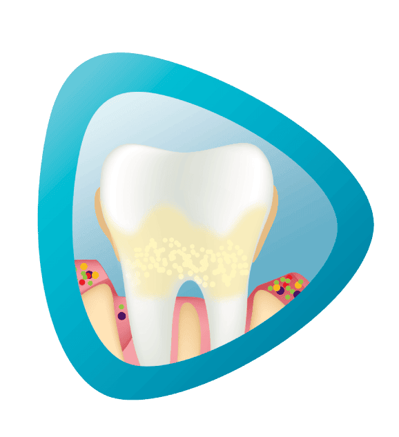 Ikona zęba z zakażonymi dziąsłami